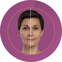 Fab_Website_Services_1. Anti-Ageing-Treatment