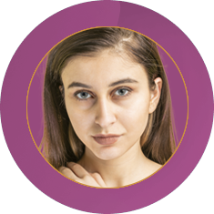 Fab_Website_Services_10. Dark-Circle-Removal