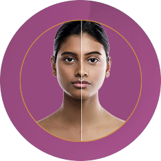 Fab_Website_Services_2. Skin-Pigmentation-Treatment