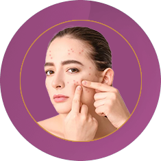 Fab_Website_Services_9. Acne-Treatment