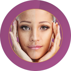 Fab_Peptide Facial