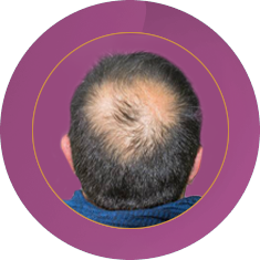 Fab_Website_Services_Hair patch