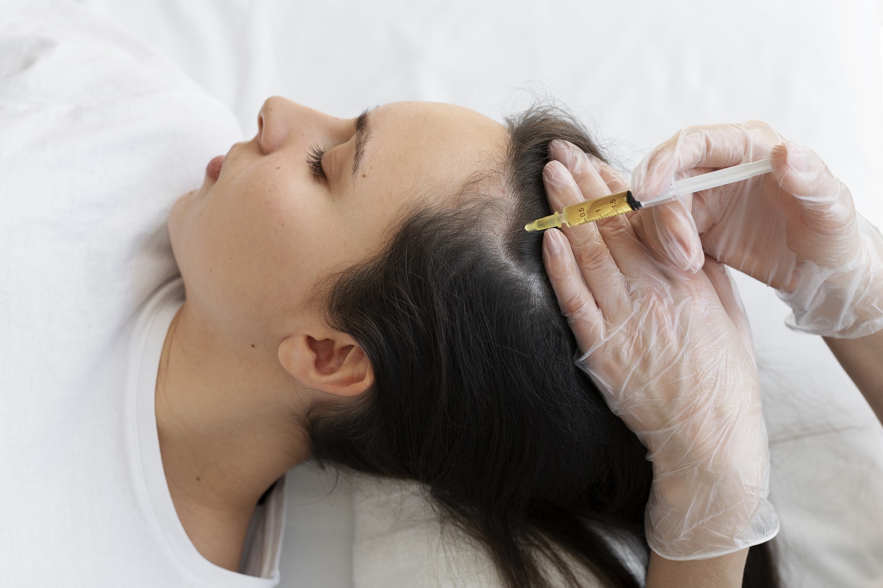 woman-getting-scalp-prp-treatment-high-angle